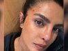 Priyanka-Chopra-Jonas-shares-another-bloodied-up-picture-from-work